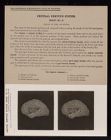 Central Nervous System. Brain - no. 15